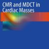 CMR and MDCT in Cardiac Masses From Acquisition Protocols to Diagnosis