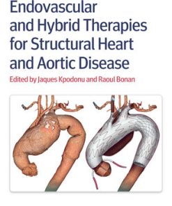 Endovascular and Hybrid Therapies for Structural Heart and Aortic Disease
