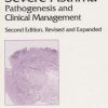 Severe Asthma Pathogenesis and Clinical Management