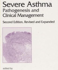 Severe Asthma Pathogenesis and Clinical Management