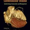 Metabolic Syndrome and Cardiovascular Disease Epidemiology Assessment and Management