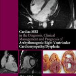 The Cardiac MRI in Diagnosis Clinical Management And Prognosis Of Arrhythmogenic Right Ventricular Cardiomyopathy Dysplasia