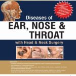 Diseases of Ear, Nose and Throat With Head and Neck Surgery 2nd Edition