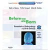 Before We are Born  Essentials of Embryology and Birth Defects  8th Edition