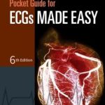 Pocket Guide for ECGs Made Easy 6th Edition