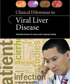Clinical Dilemmas in Viral Liver Disease