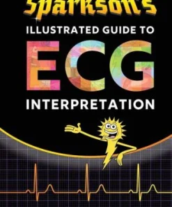 Sparkson's Illustrated Guide to ECG Interpretation