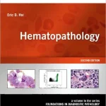 Hematopathology 2nd Edition