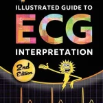 Sparkson's Illustrated Guide to ECG Interpretation 2nd Edition