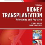Kidney Transplantation Principles and Practice 7th Edition