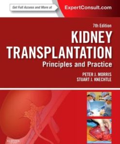 Kidney Transplantation Principles and Practice 7th Edition