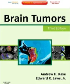 Brain Tumors 3rd Edition