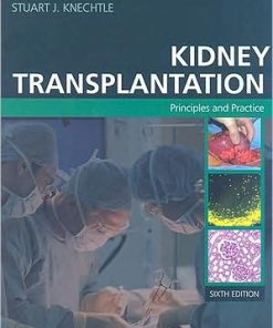 Kidney Transplantation Principles and Practice 6th Edition