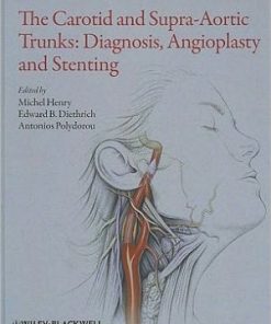The Carotid and Supra Aortic Trunks Diagnosis Angioplasty and Stenting