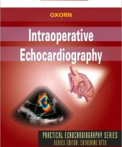 Intraoperative Echocardiography