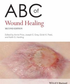 ABC of Wound Healing 2nd Edition