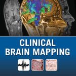 Clinical Brain Mapping