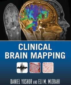 Clinical Brain Mapping