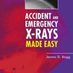Accident and Emergency X rays Made Easy