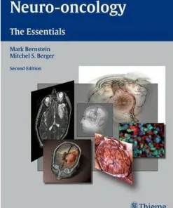 Neuro oncology The Essentials 2nd Edition