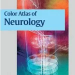 Color Atlas of Neurology