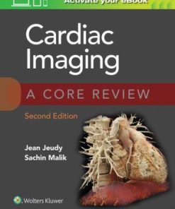 Cardiac Imaging 2nd Edition