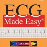 ECG Made Easy 6th Edition