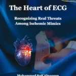 The Heart of ECG Recognizing Real Threats Among Ischemic Mimics
