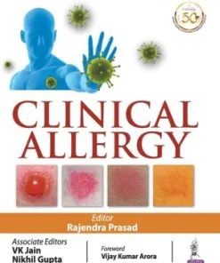 Clinical Allergy
