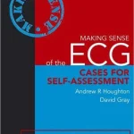 Making Sense of the ECG Cases for Self assessment