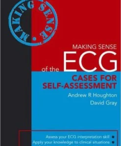 Making Sense of the ECG Cases for Self assessment