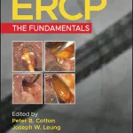 ERCP The Fundamentals 3rd Edition