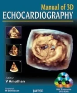 Manual of 3D Echocardiography