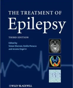 The Treatment of Epilepsy 3rd Edition