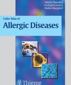 Color Atlas of Allergic Diseases