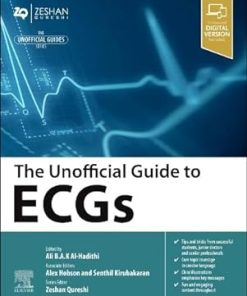 The Unofficial Guide to ECGs