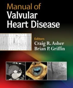 Manual of Valvular Heart Disease