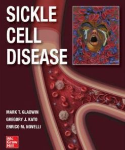 Sickle Cell Disease