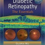 Diabetic Retinopathy The Essentials