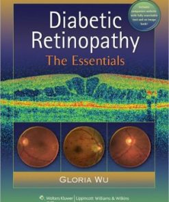 Diabetic Retinopathy The Essentials