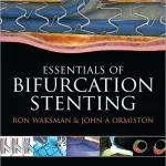 Bifurcation Stenting