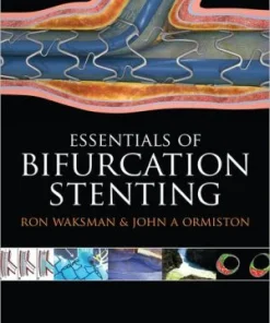 Bifurcation Stenting