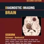 Diagnostic Imaging: Brain 2nd Edition