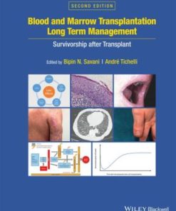 Blood and Marrow Transplantation Long Term Management 2nd Edition