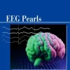 Eeg Pearls