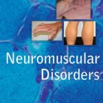 Neuromuscular Disorders