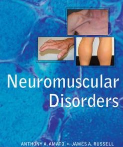 Neuromuscular Disorders