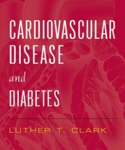 Cardiovascular Disease And Diabetes