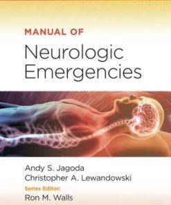 Manual of Neurological Emergencies