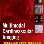 Cardiovascular Multimodal Image Guided Diagnosis And Therapy